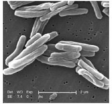 SEM image of Mycobacterium tuberculosis by Janice Carr - released into public domain by CDC