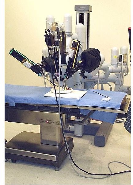 What is Robotic Surgery and How does it Work?