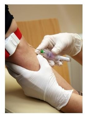 Learn What the HCT Blood Test is for and What the Results Mean