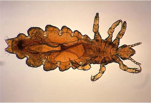 Head Louse - Image Credit: PD-USGOV-HHS-CDC