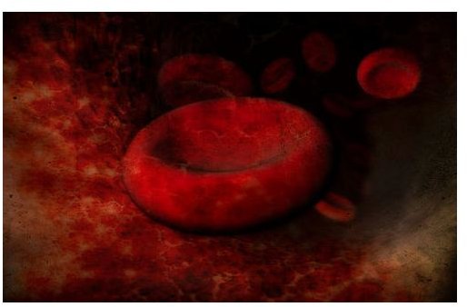 MPV Blood Test Information and How Mean Platelet Volume Levels Can Help Identify Bone Marrow Issues