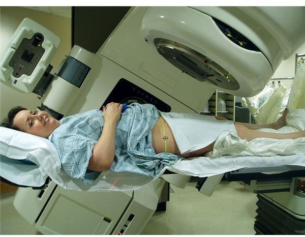 Side Effects of Radiotherapy for Cancer