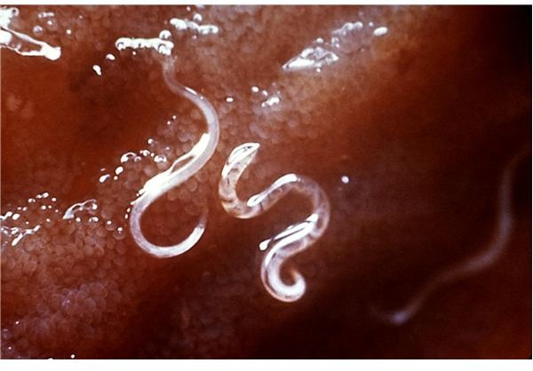 Hookworms in Humans: Gene Studies to Tackle the Symptoms of Hookworm Infections