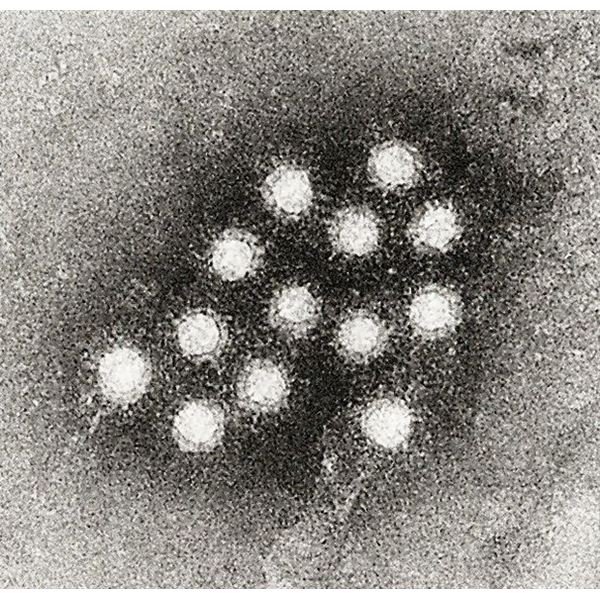 620px-Hepatitis A virus 02