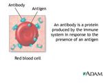 What is Serum Sickness: Understanding Allergic-Like Reactions