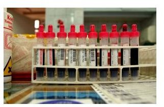 Common Lab Tests Explained: Reasons for Testing and Test Preparation