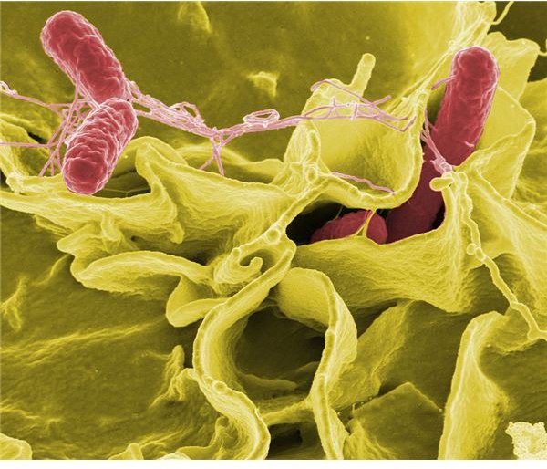 What Are The Five Most Common Pathogens That Can Cause Foodborne Illnesses