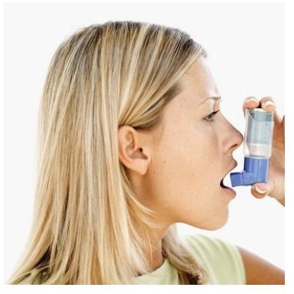 Albuterol Inhaler