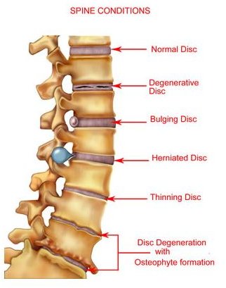 What Medical Conditions Qualify for Disability?