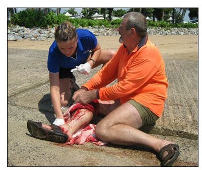 Injuries from Shark Attack