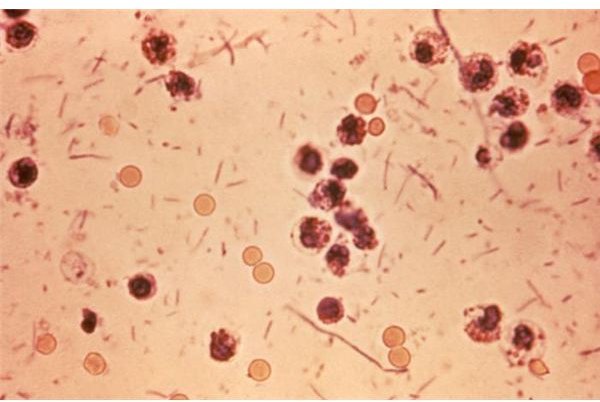 The Facts about Shigella Bacteria - A Look at Bacteria + Shigella