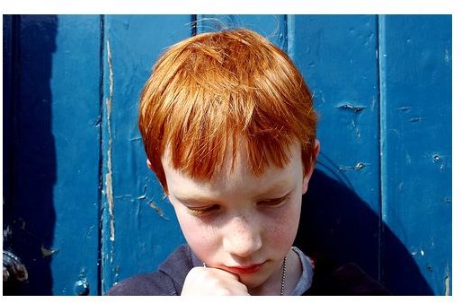 The Genetics of Red Hair: What Causes Natural Red Hair?