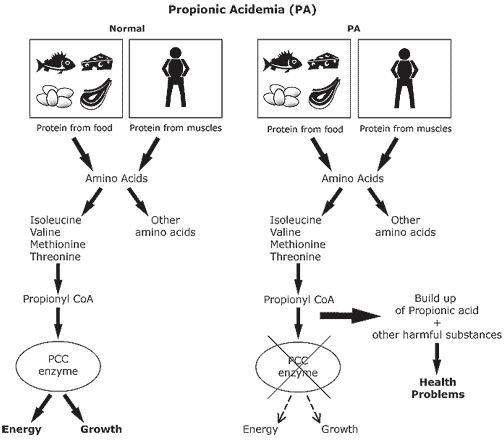 The Basics of the Metabolic Disorder Propionic Acidemia