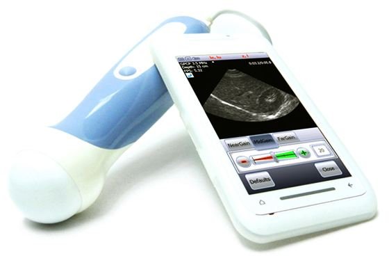 Ultrasound on a Windows Mobile Smartphone: Futuristic & Dated, All at the Same Time