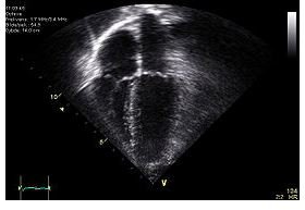 what-is-a-cardiovascular-technician-bright-hub