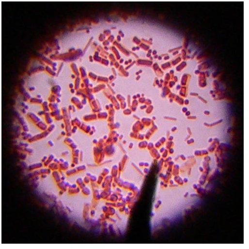 Some Basic Facts About Cocci Bacteria (Spherical Shaped Bacteria)