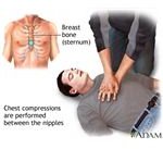 cpr high chest compression fraction