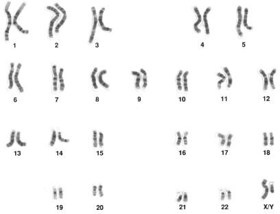 The Race for the $1000 Genome Project.  The Cost of Personal Genome Analysis is Coming Down