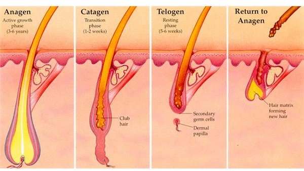 Laser Hair Removal