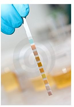 The Medical Urinalysis Procedure: How It Is Performed and What the Values Mean