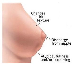 Learn How to Perform a Self Breast Exam