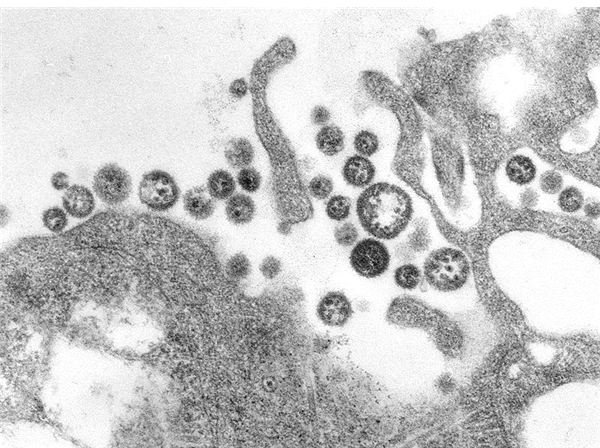 Lassa Fever: A Disease Spread by Multimammate Rodents