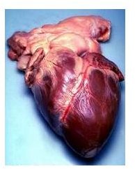 Important Facts on Heart Disease: Facts and Statistics on Heart Disease in America and the World