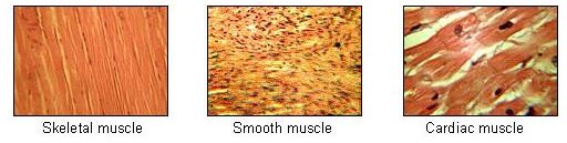 Dystrophia Myotonica - The Cause of the Muscle Wasting Disease  Myotonic Dystrophy