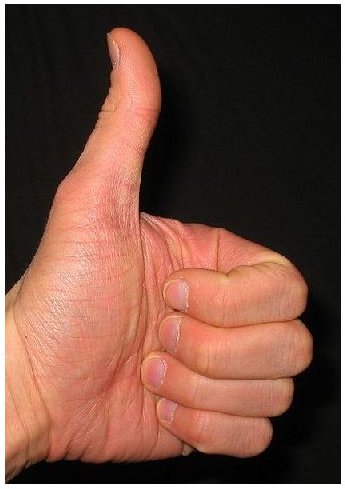 Thumbs Up Wikimedia Commons