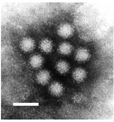 What Are Noroviruses?  Plus How Does Norovirus Cause Gastroenteritis?