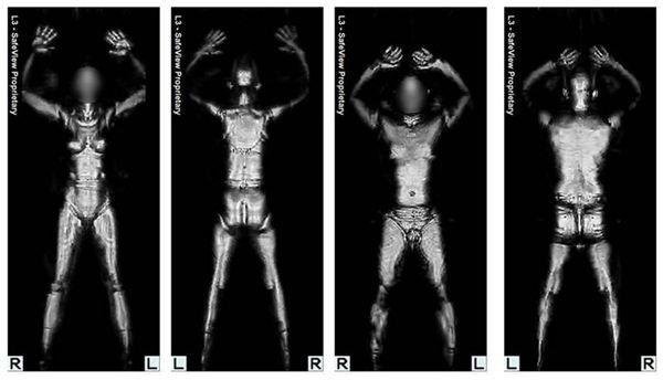 Full Body Scan Image Airport Screening - Millimeter Wave Scanning Technology and Backscatter X-ray Machines