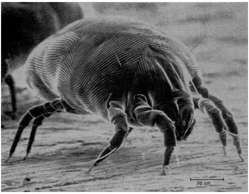 Dust Mite Allergies: Symptoms and Testing for This Common Allergen in the Home