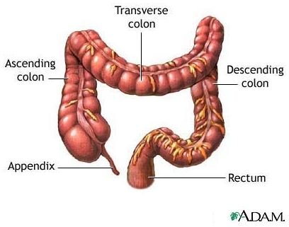 Preventing Colon Cancer: Causes and Prevention