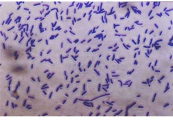 Names of Common Bacteria: The Good, the Bad, and the Ugly
