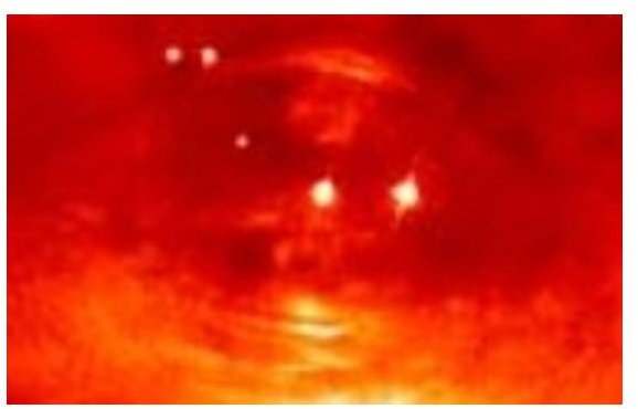 Pulsar in Crab Nebula (star in center)
