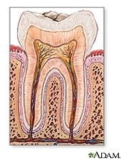 Home Remedies for Toothaches: Get Natural Relief for Toothache Pain