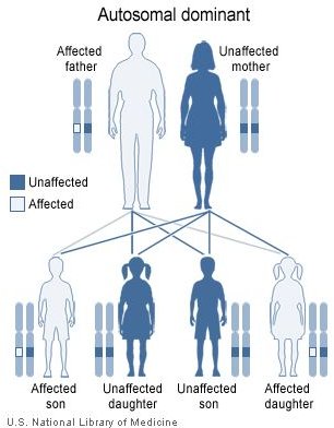 Learn the Answer to: How is Treacher Collins Syndrome Inherited?
