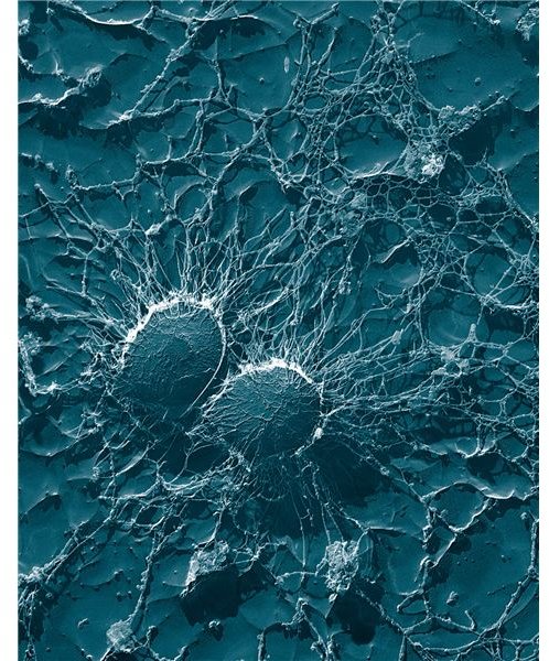 List of Bacteria on the Human Body: Compiling an Atlas Of Common Bacteria Types on Humans to Help Fight Disease