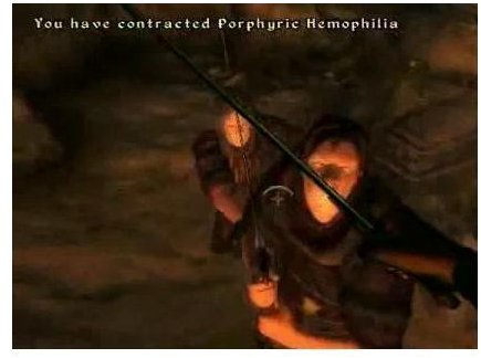 Porphyric Hemophilia