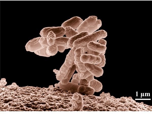 E. Coli in Electron Microscope